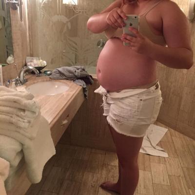 FattyKatty – Barriga grande com estrias