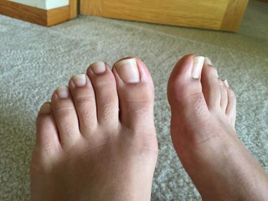 Could You Fit These Plump Toes In Your Gob!