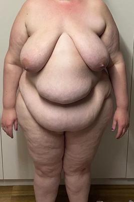 BBWs sterben für CXI