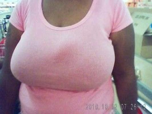 乳房観察